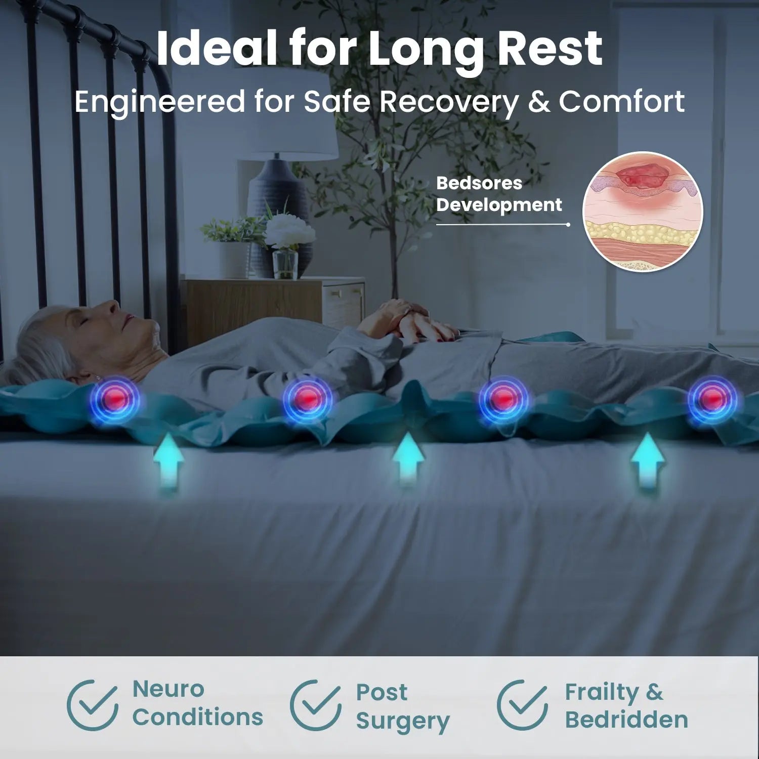 Alternating Air Pressure Mattress